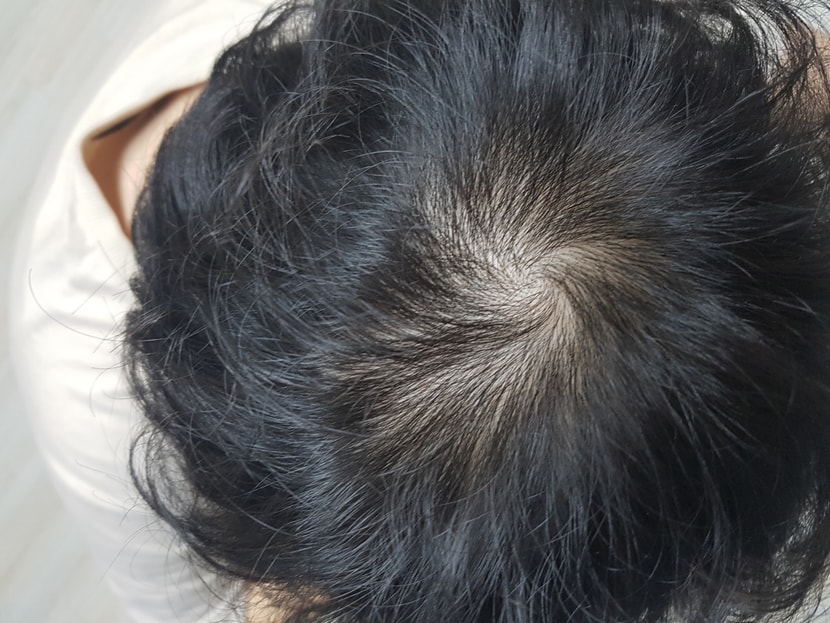 관리전? 관리 한달차?