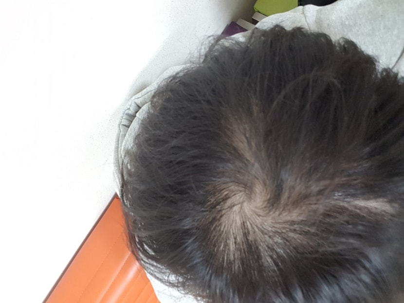 관리 약6달 + 어성초비누2달