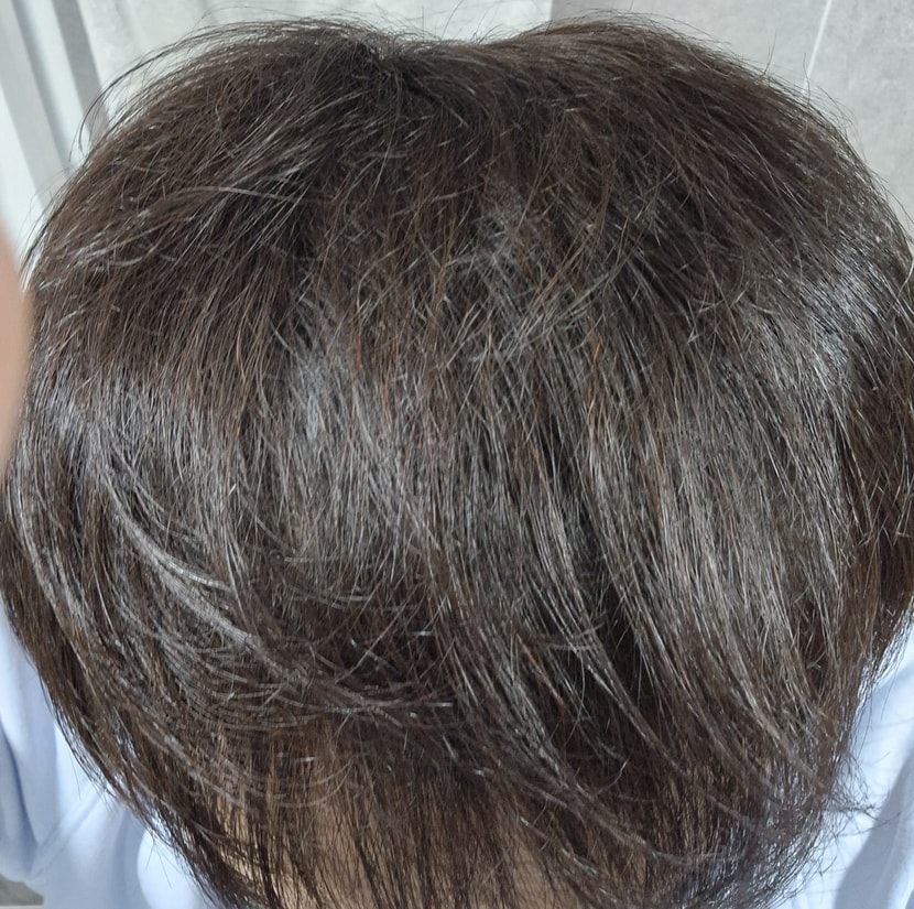 약 먹은지 100일 후