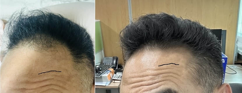 처음 24년5월 versus 지금 25년3월