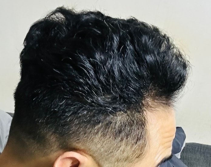 정수리에서 앞쪽까지 좀 더 빽빽해지면 좋겠네요.