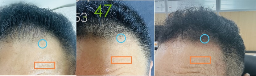 예전 비교사진이네요.