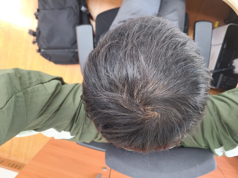 복용전