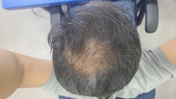 현재 오늘 사진