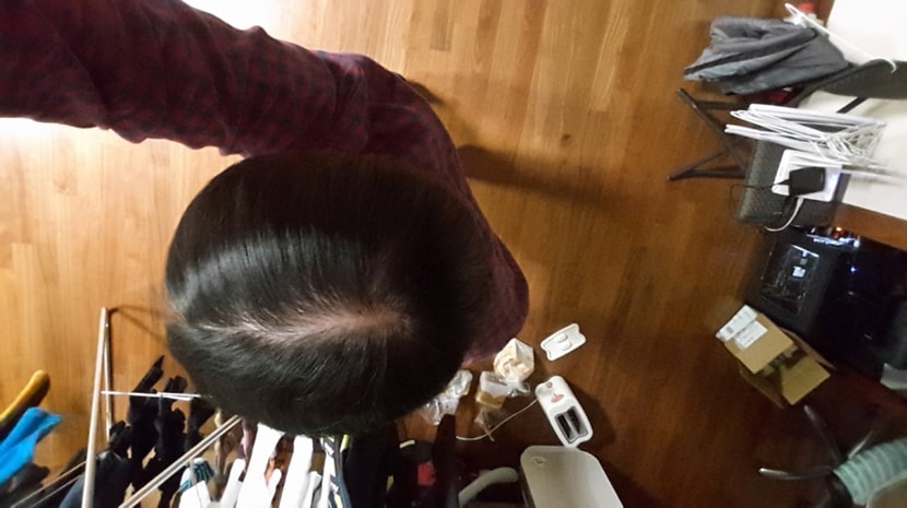 현재(요즘 많이 다시 휴지기인 상태,1개월 전에는 이것 보다도 훨씬 좋았음)