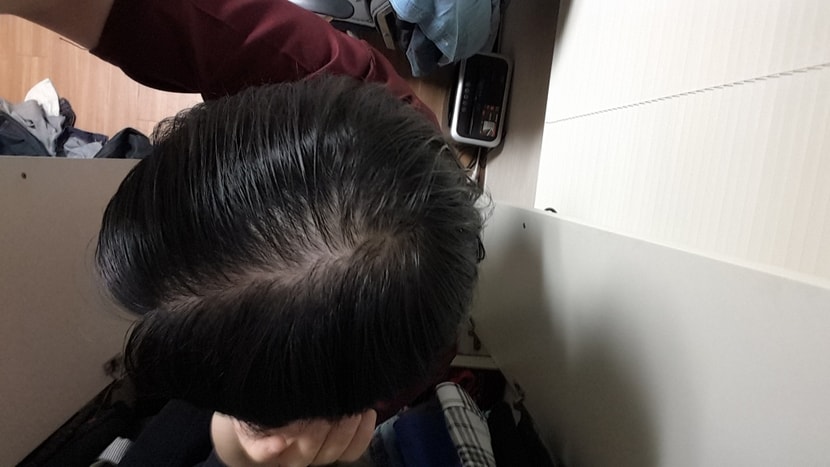 현재(요즘 많이 다시 휴지기인 상태,1개월 전에는 이것 보다도 훨씬 좋았음)