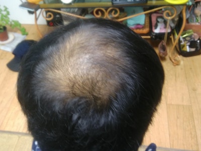 미노페시아 8개월 경과보고입니다.