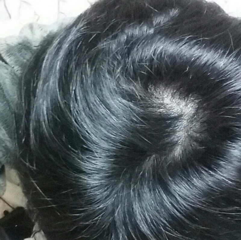 피나 170일차 (기록용)