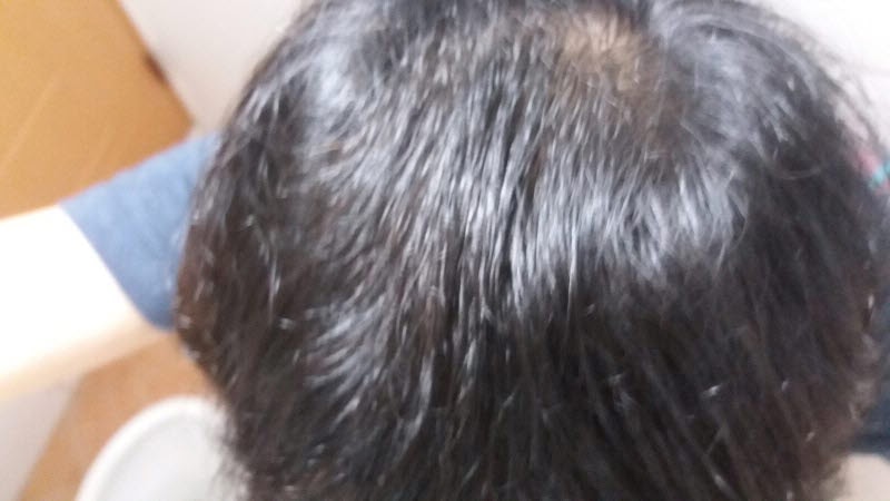 9월 머리감은 후 머리 앞으로 빗질