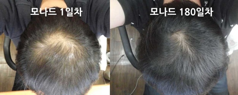 모나드 180일차 입니다. 효과 좋은거 같아요