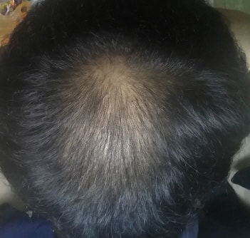 Fina+Minok 4个月后的后记