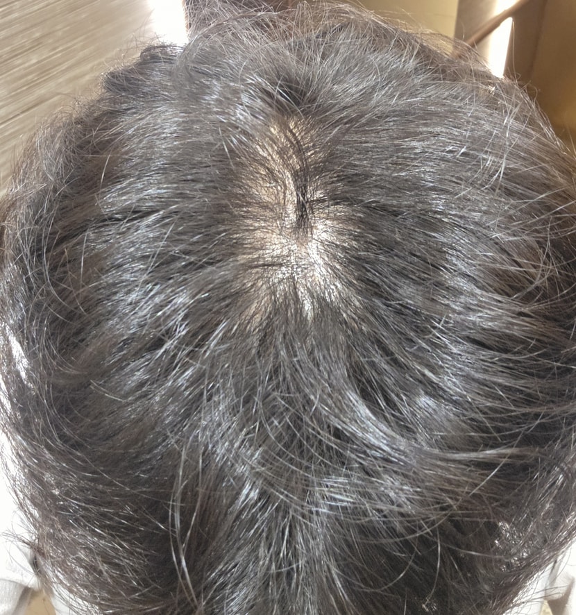 시작전 상태 (3개월전)