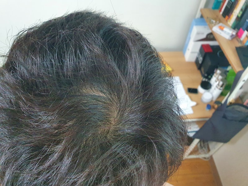 アボダート4ヶ月目の生々しい後期(ヶ月別写真付き)