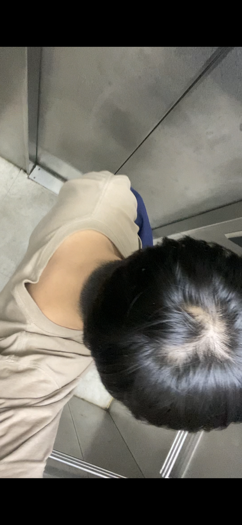 ミノキシジルマン4週間後記