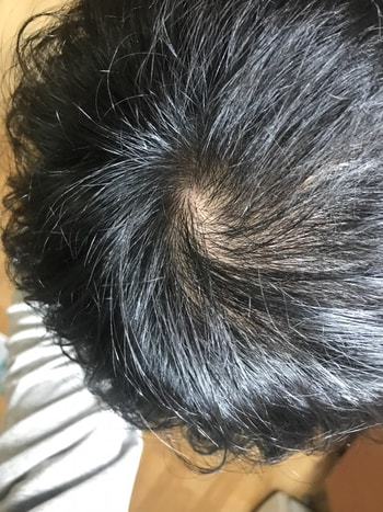 솔직히 나아진건없음 .