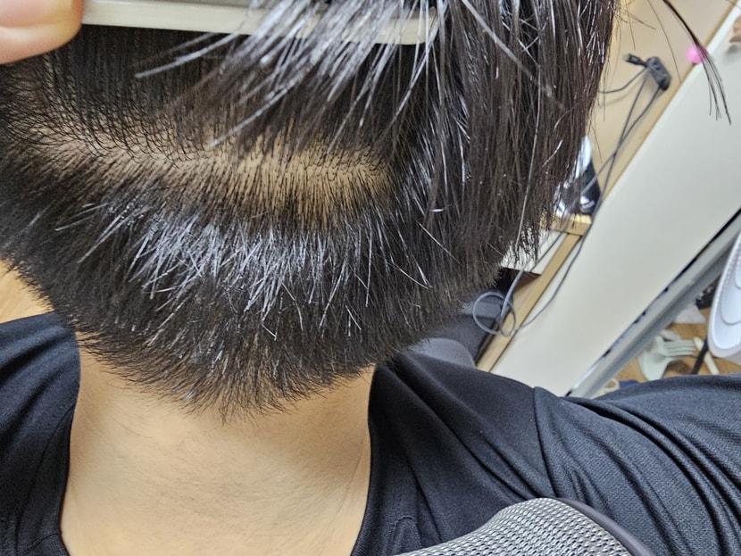 뒷머리