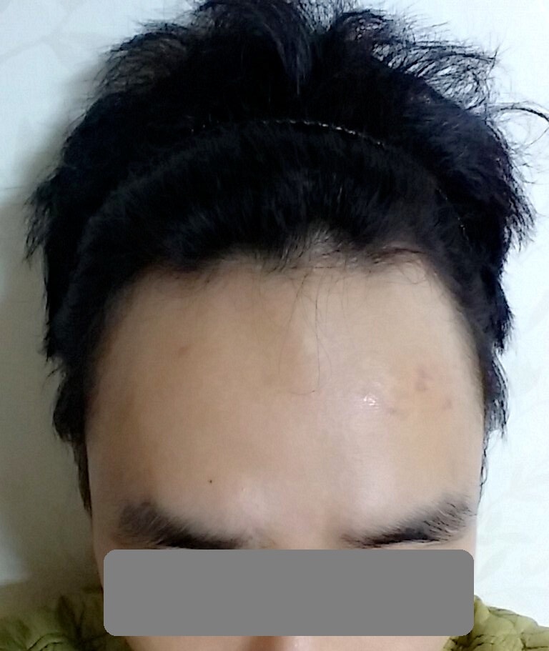 수술전 라인 보이시나요