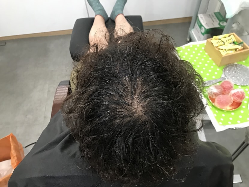 시술전.