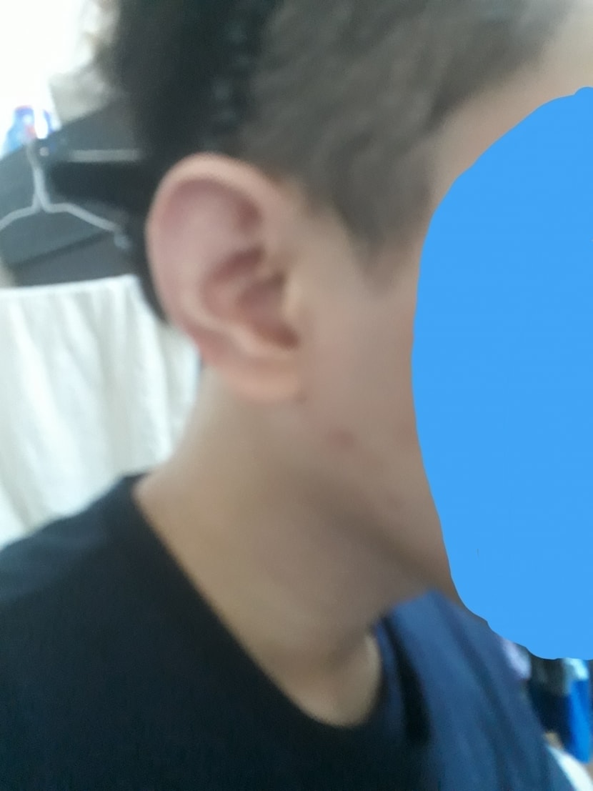 오른쪽 구렛나루