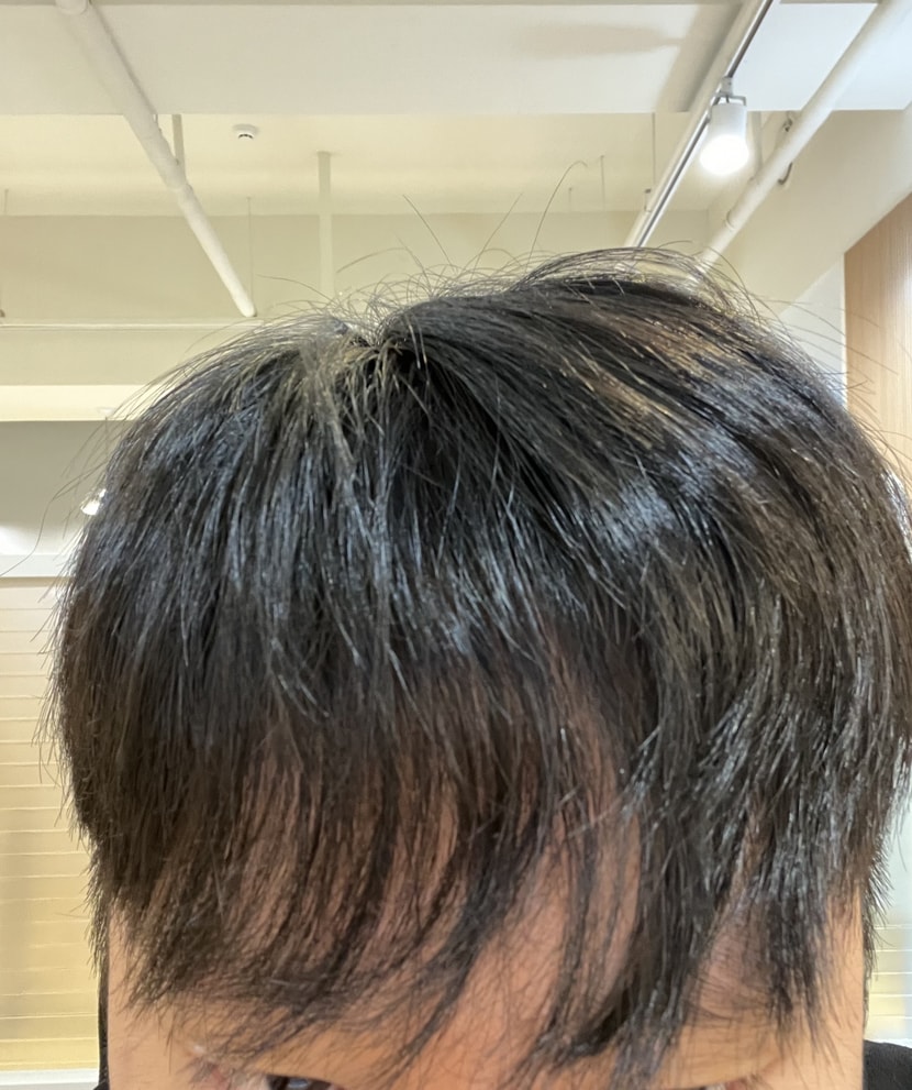 머리 막 흔들면 이리됩니다