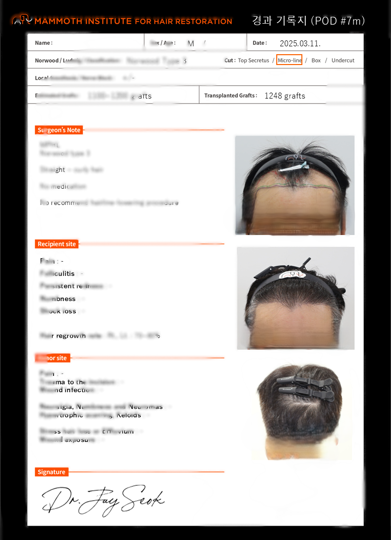 Apgujeong Mammoth Hair Restoration Center Hairline Bluetooth Hair Transplant 7 months ago.