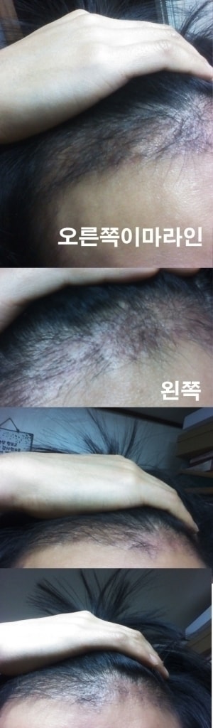 4개월사진.jpg