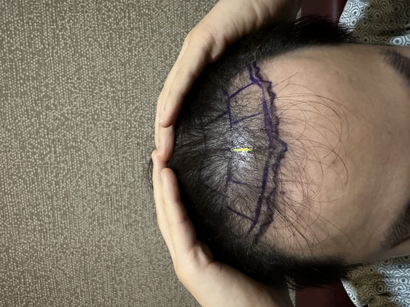 포토후기 이미지