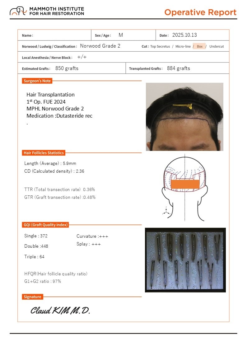 포토후기 이미지