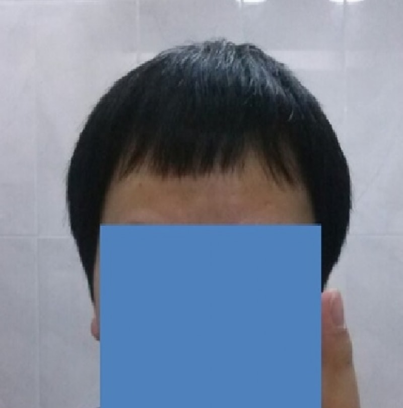 수술전3.jpg