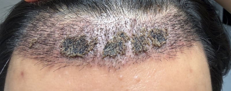 포토후기 이미지