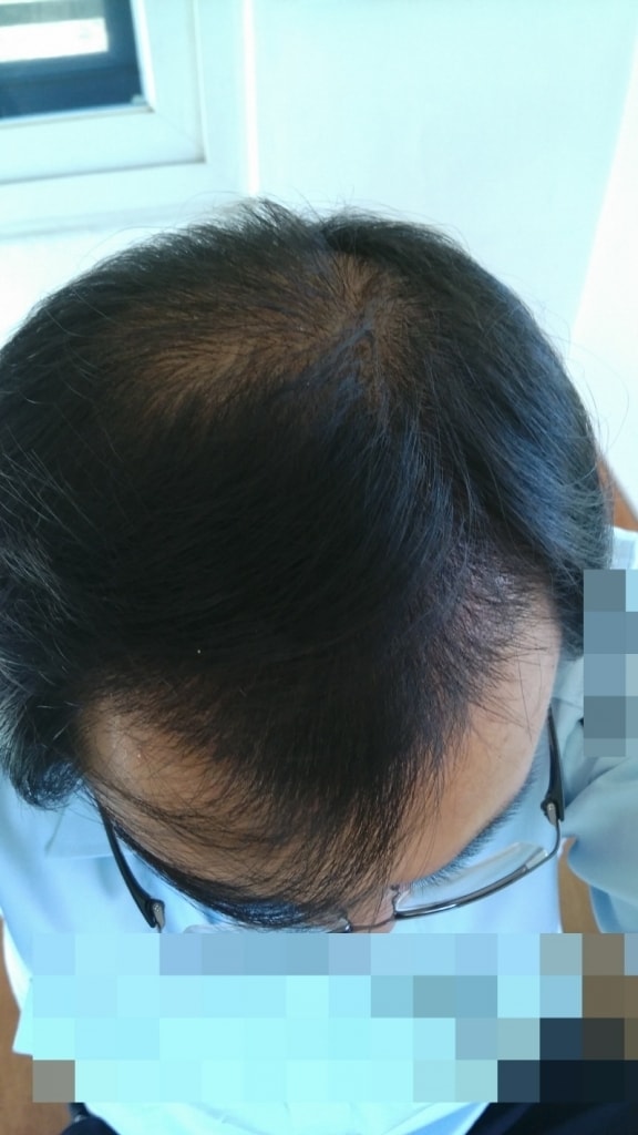 크기변환_꾸미기_꾸미기_20150918_094643.jpg