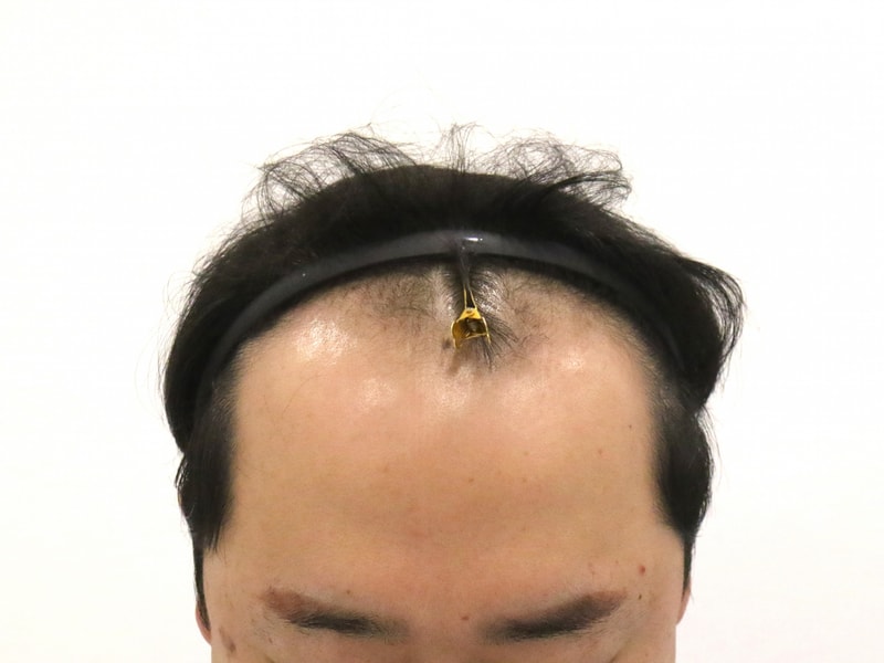 포토후기 이미지
