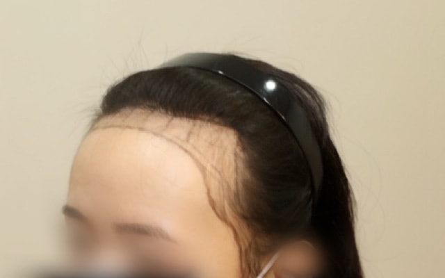 상담 당일 왼쪽