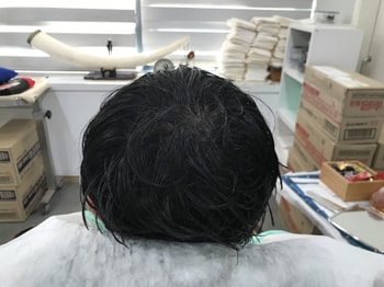 리터치 후