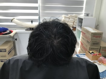 리터치 전