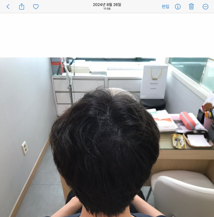 4년 경과