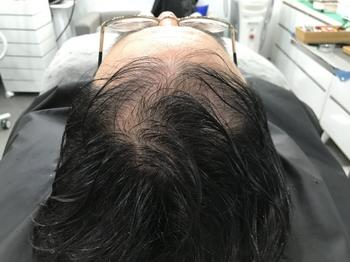 문신 전