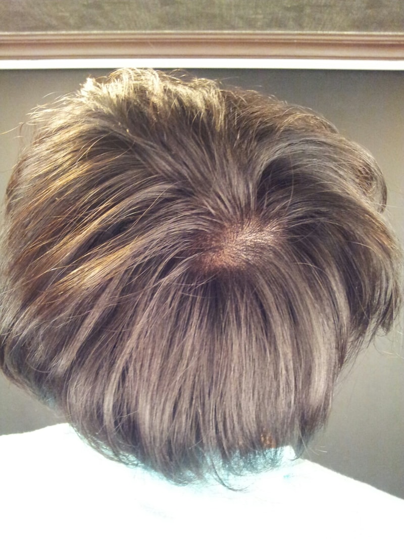 드디어 두피문신 후기올리게되네요!