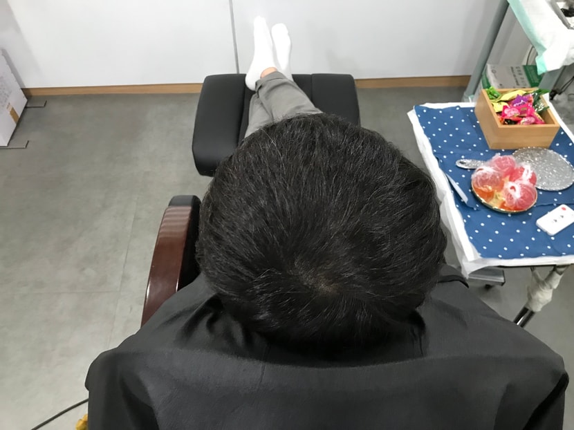 리터치전 머리