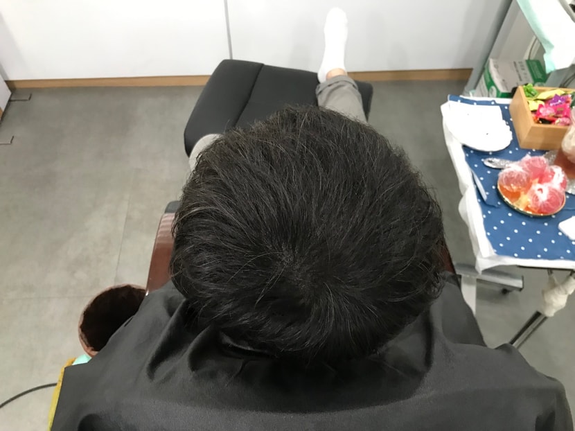 리터치후 머리