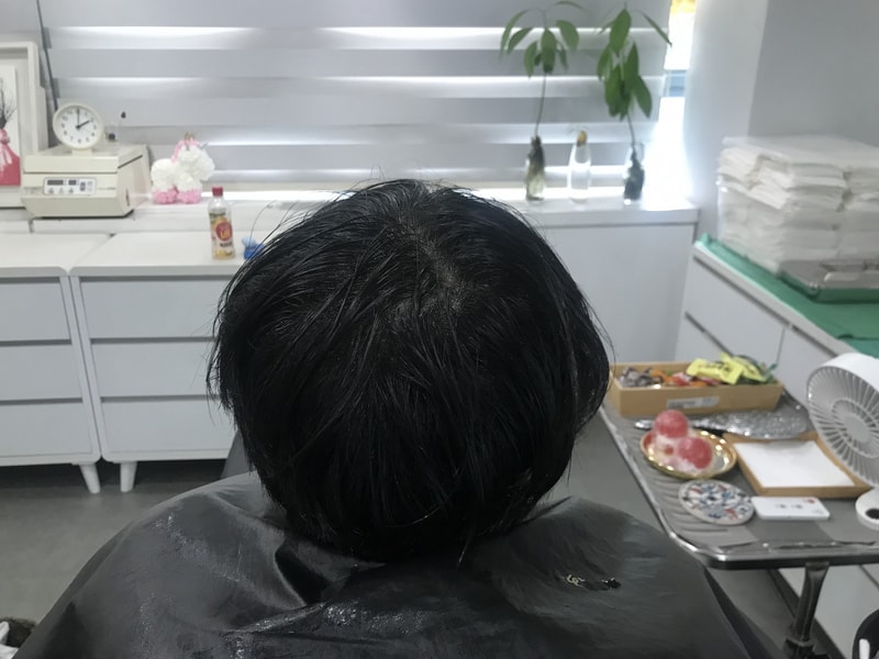 multiple smp头皮纹身二次修护