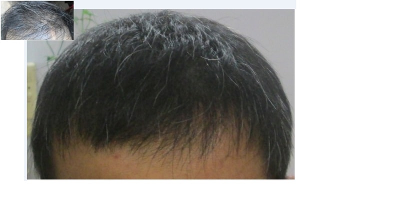 如果早有人告诉我这种绝妙的方法……