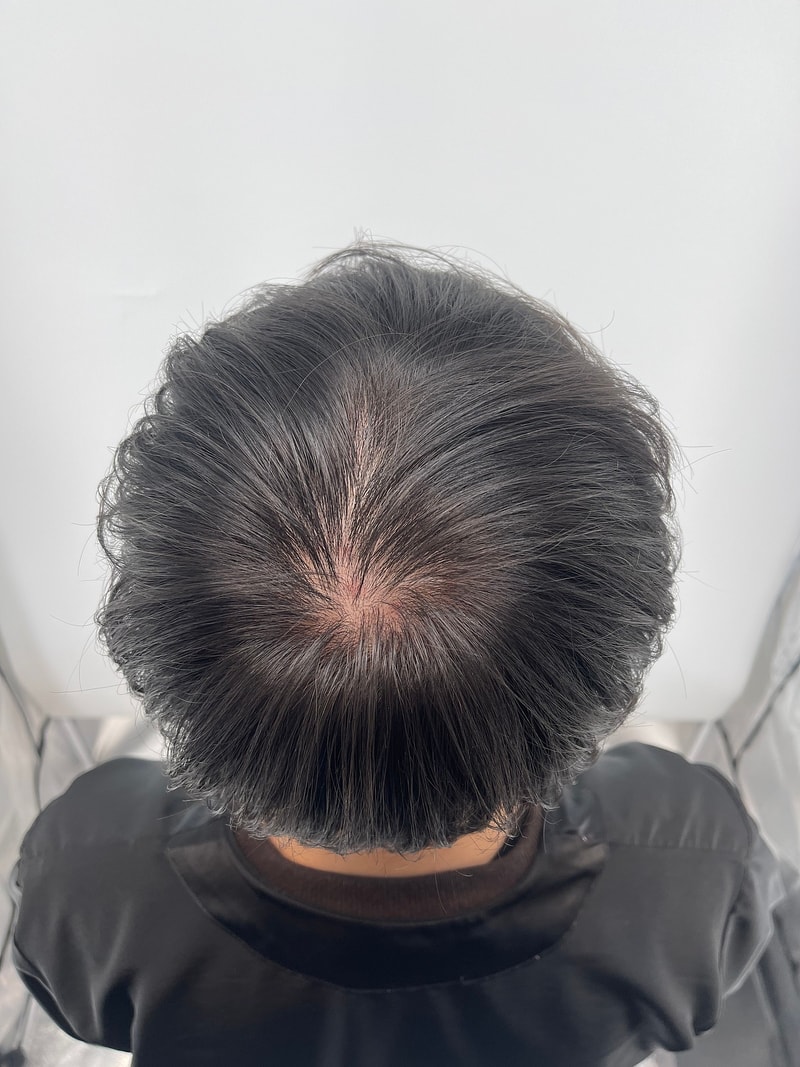 New Hair 头皮纹身后记