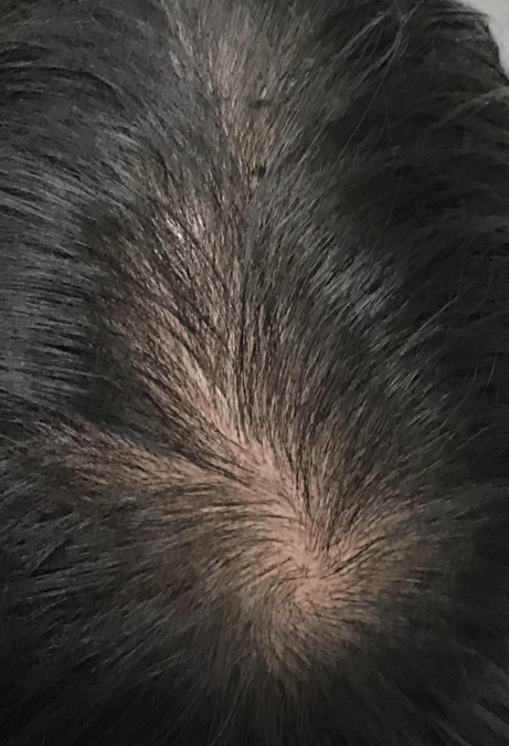 延世美达人头皮纹身真的是100%蒸的后记。