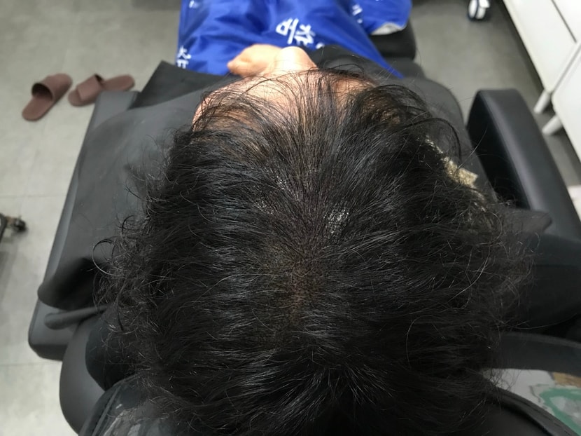 머리말린 후