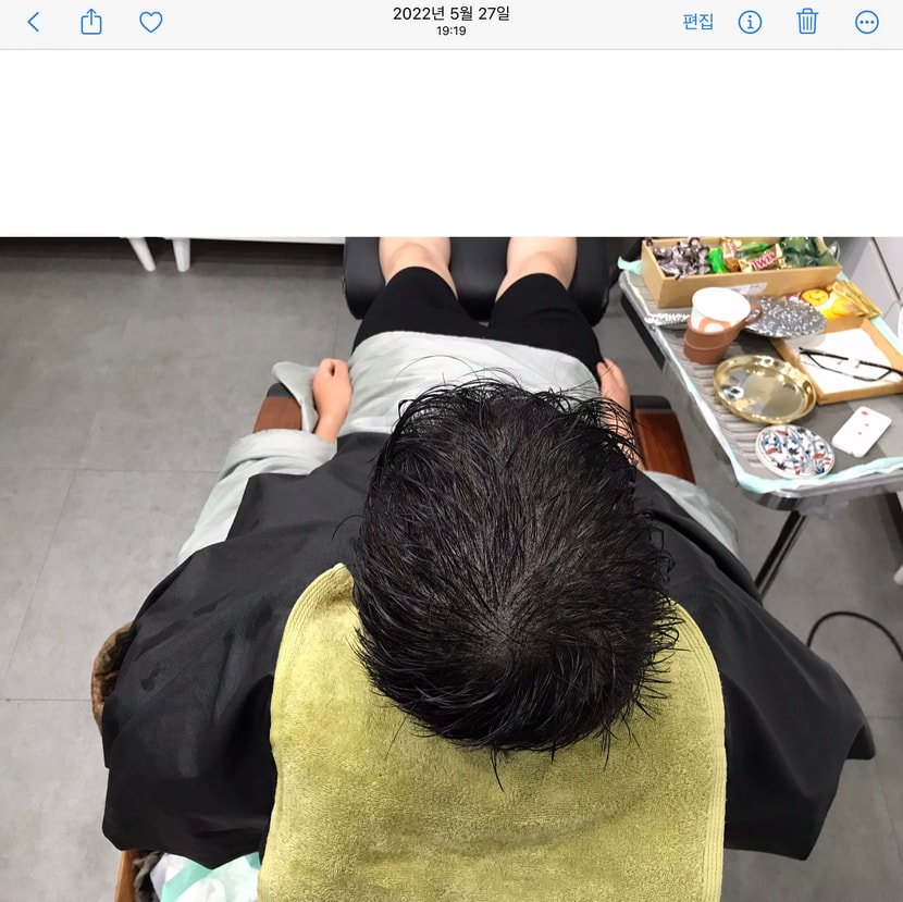 시술 후 젖은 상태 위