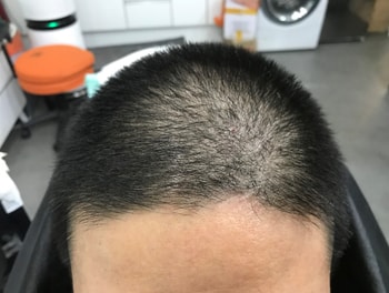짧게 자르고 시술전