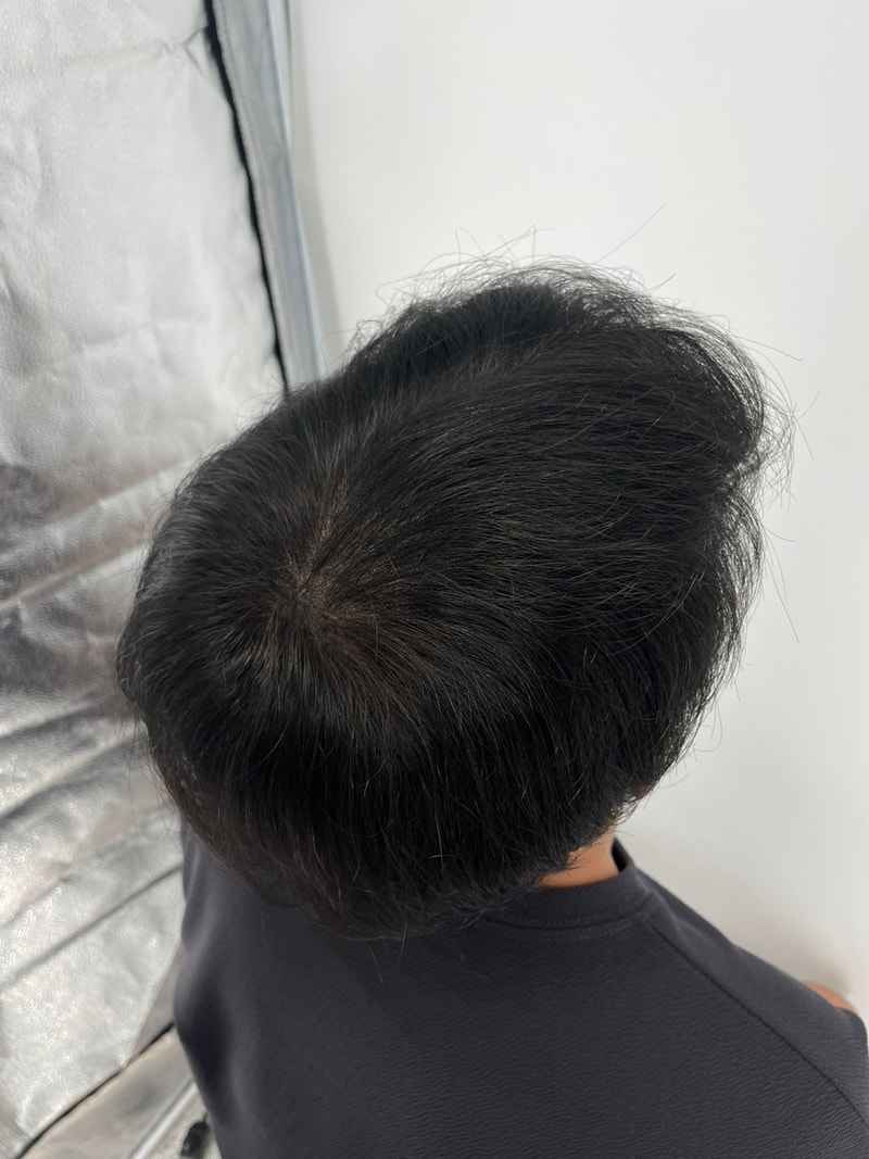新头皮纹身后期
