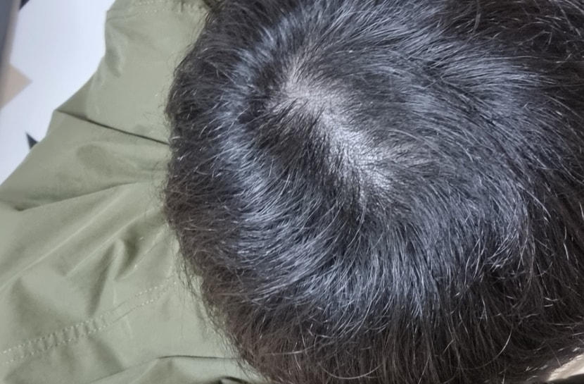 2차 끝나고 집에서 찍은사진입니다!