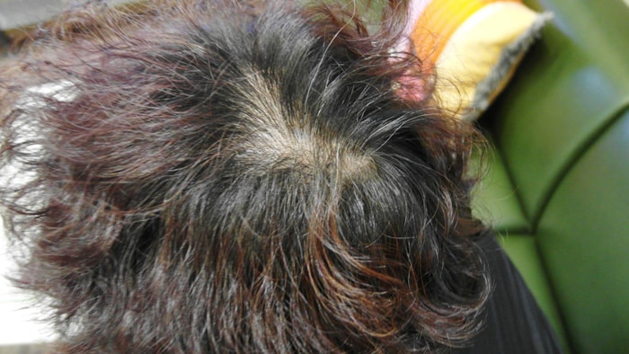 妈妈头顶上纹了头皮